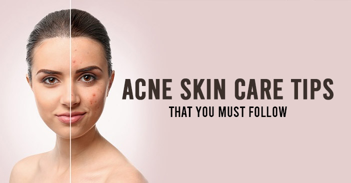 Acne-Skin-Care.jpg