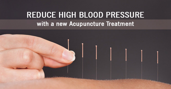 Acupuncture-Treatment.jpg