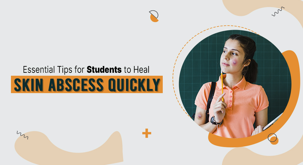 EssentialTipsforStudentstoHealSkinAbscessQuickly.jpg