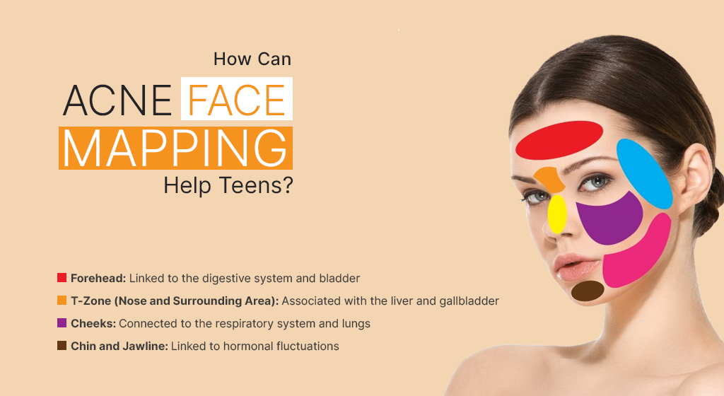 HowCanAcneFaceMappingHelpTeens.jpg
