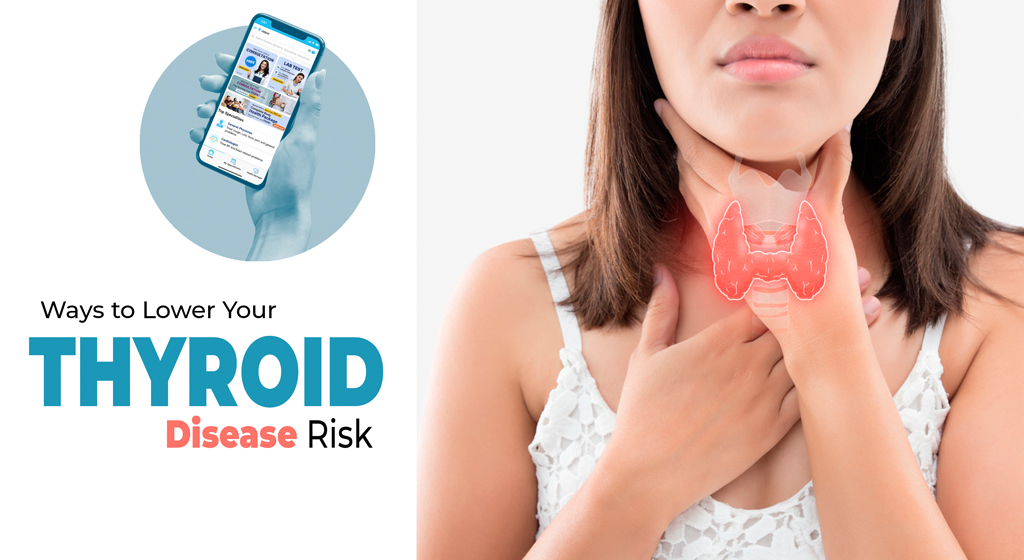 Waystoloweryourthyroiddiseaserisk.jpg