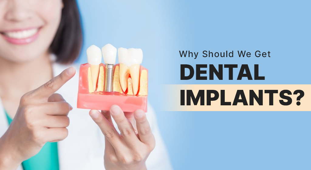 WhyShouldWeGetDentalImplants.jpg